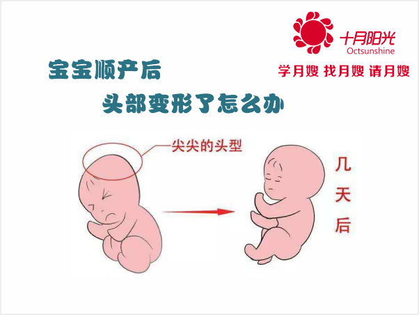 宝宝顺产后头部变形了怎么办？(图1)
