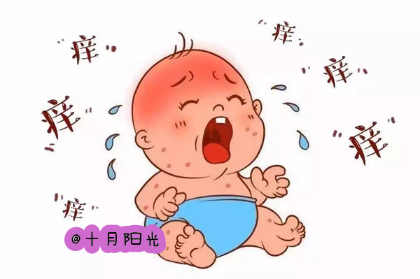 北京十大月嫂公司排名_宝宝湿疹怎么护理？(图2)